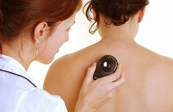 Skin-Cancer-Symptoms-Causes-and-Treatment