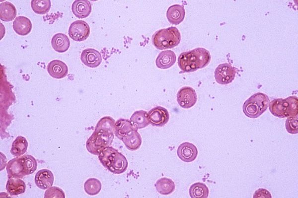 Haemophilus_influenzae_Hemoc-1-