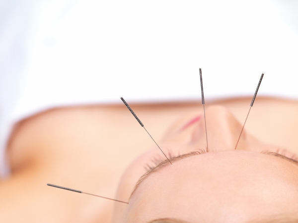 Acupuncture as alternative cancer treatment