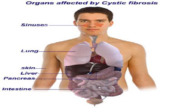 Affected organs of the body
