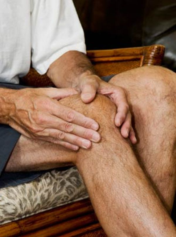 Arthritis in joints