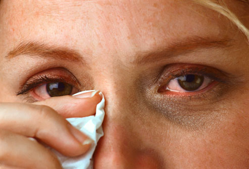 The uncomfortable condition of itchy eyes