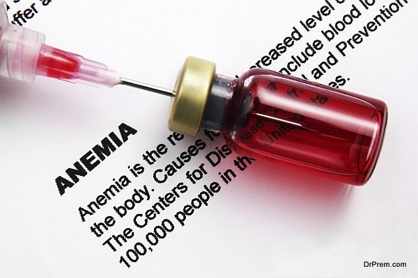 anemia 