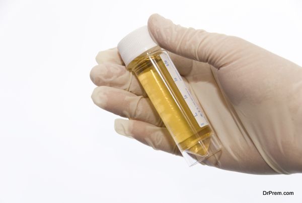 Urine Sample