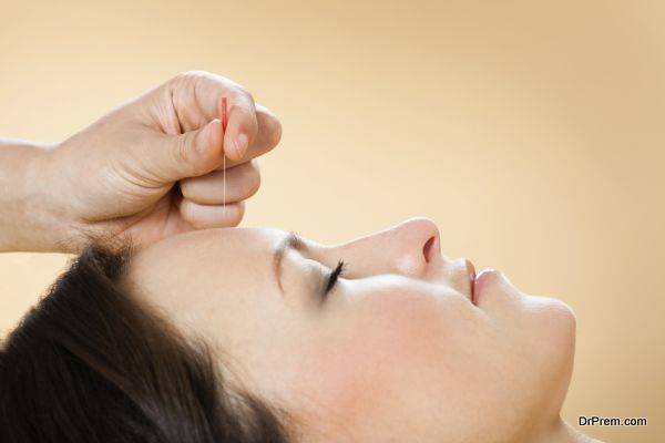 Closeup of therapist giving acupuncture treatment to female customer in beauty spa