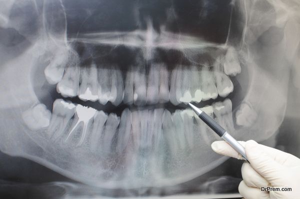 Dentist showing something on dental x-ray image