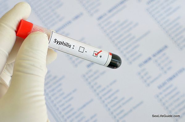 Syphilis positive