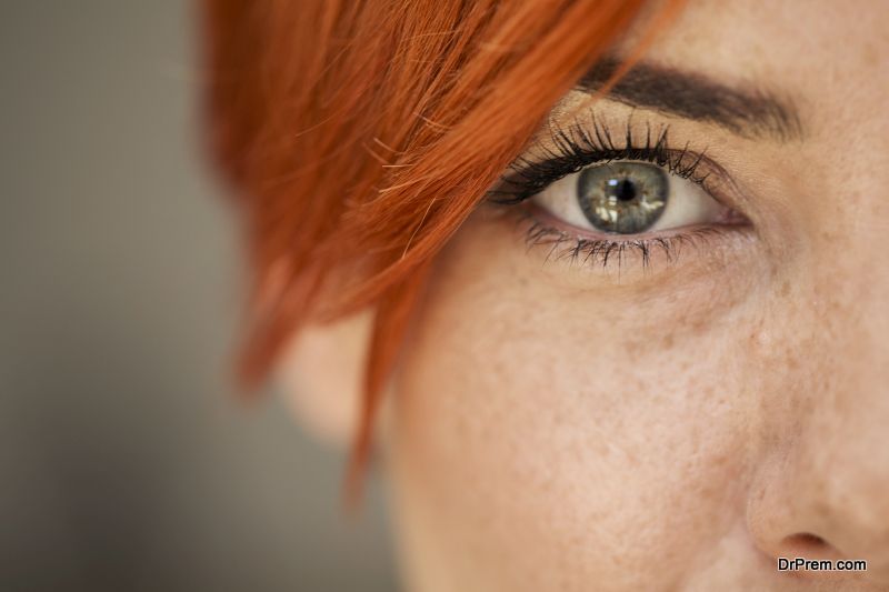 Eye-freckles