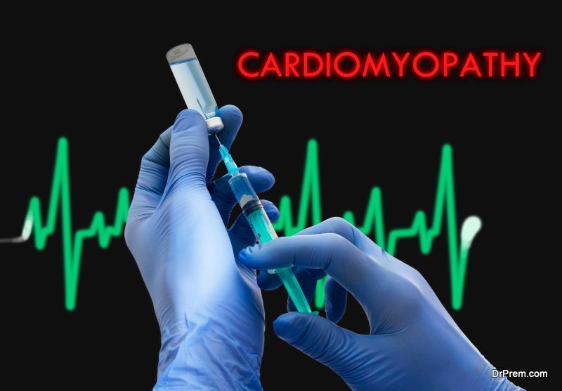 cardiomyopathy