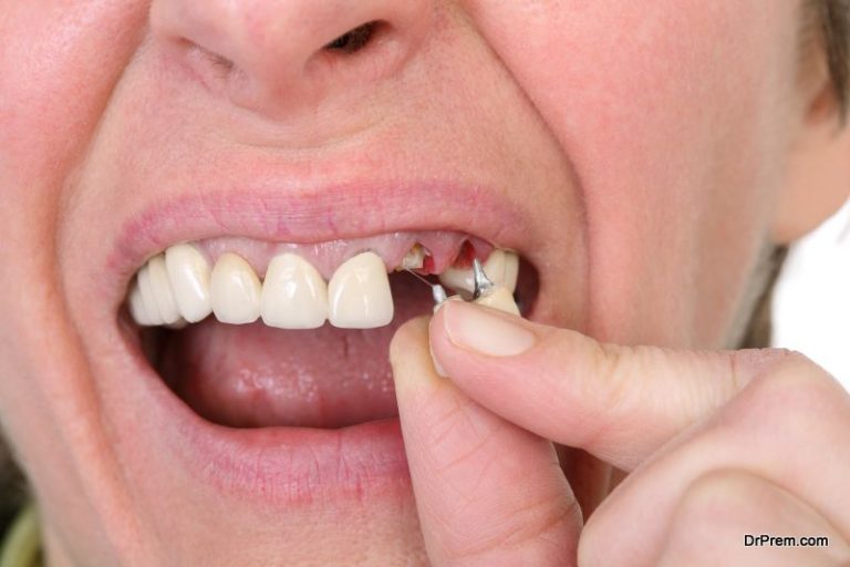 what-to-do-with-a-knocked-out-tooth-diy-health-do-it-yourself