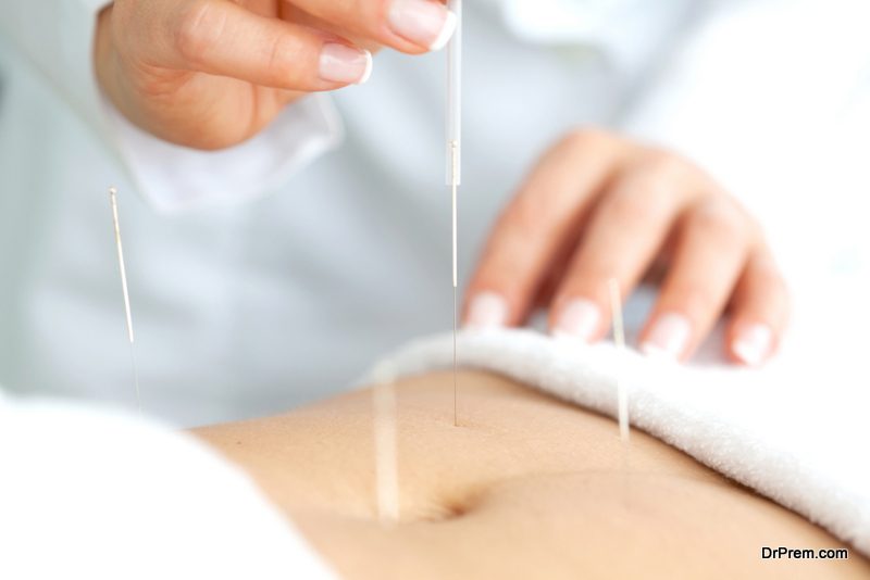  Acupuncture-For-Menopause