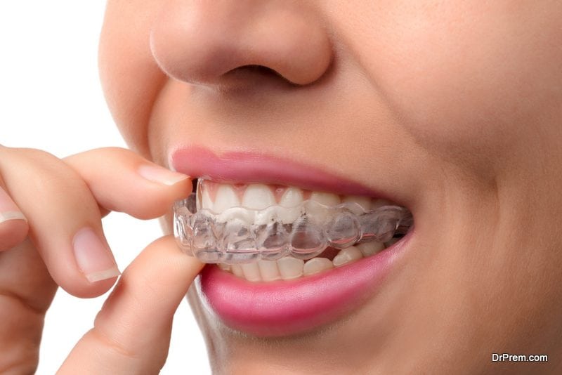 Invest In Clear Aligners