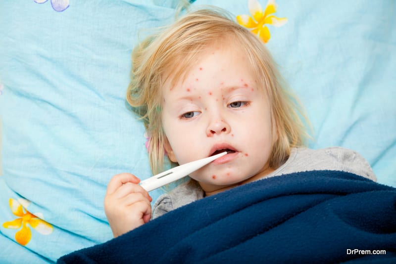 child suffering from measles