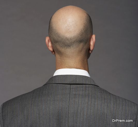 Why Does Hair Loss Happen