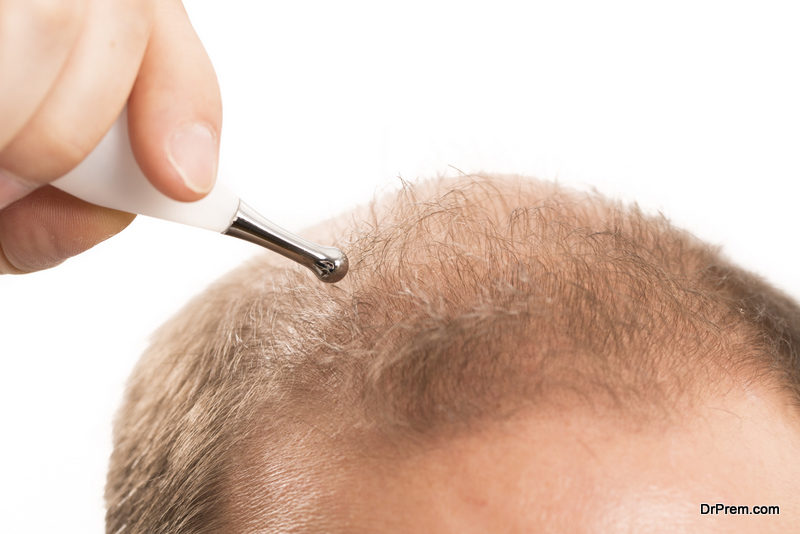 scalp-micro-pigmentation-