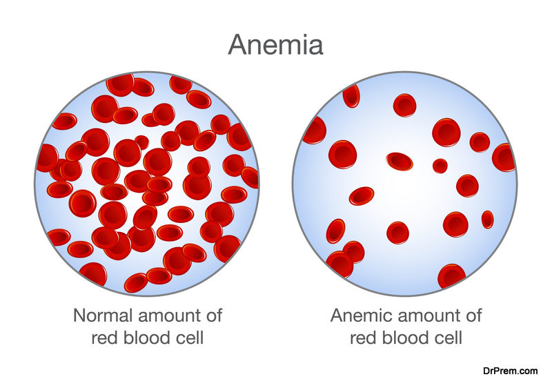 self test for Anemia