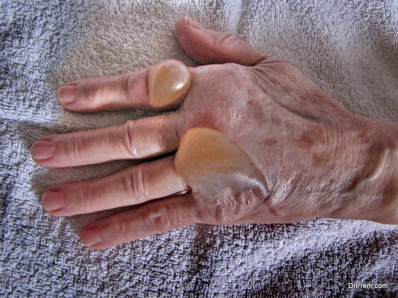 Common Injuries that Senior Citizens should be aware of