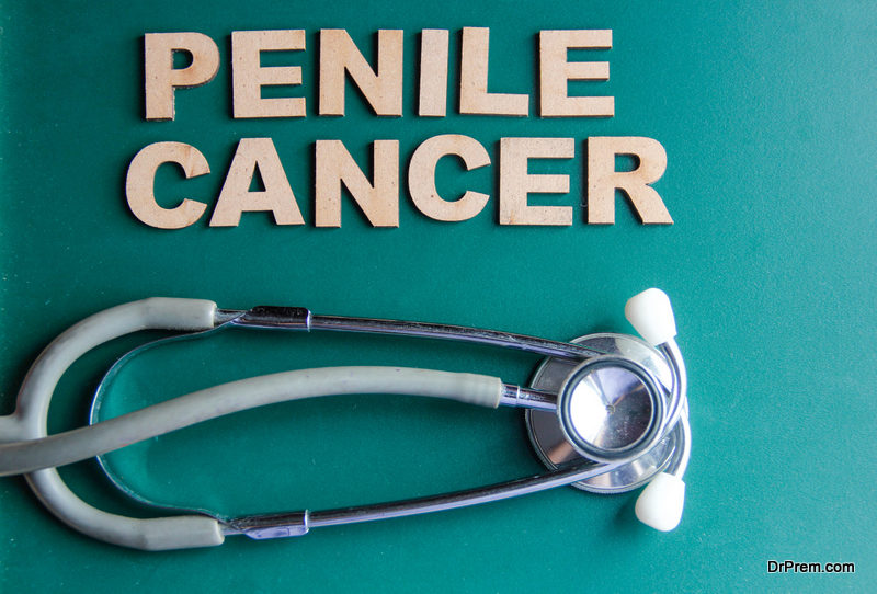 Penile Cancer