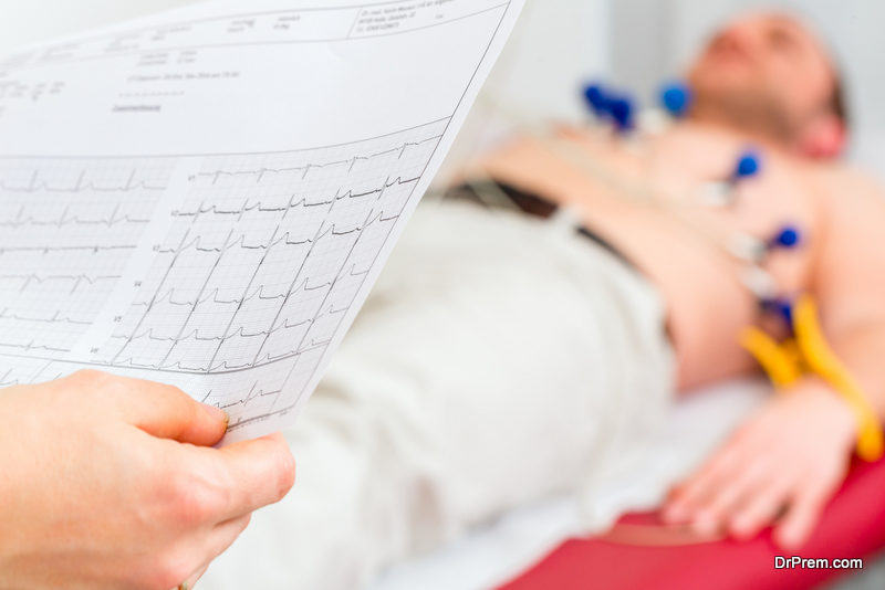 Electrocardiogram