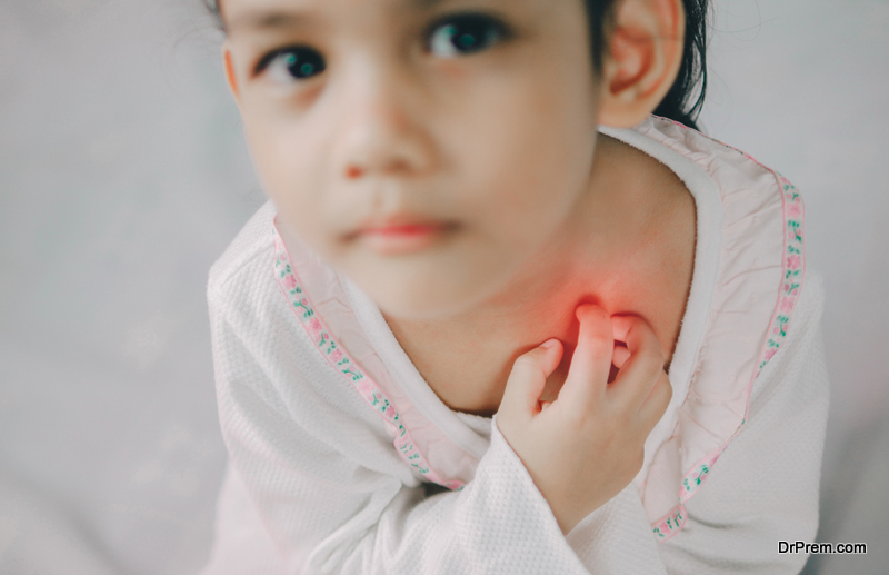 child with eczema