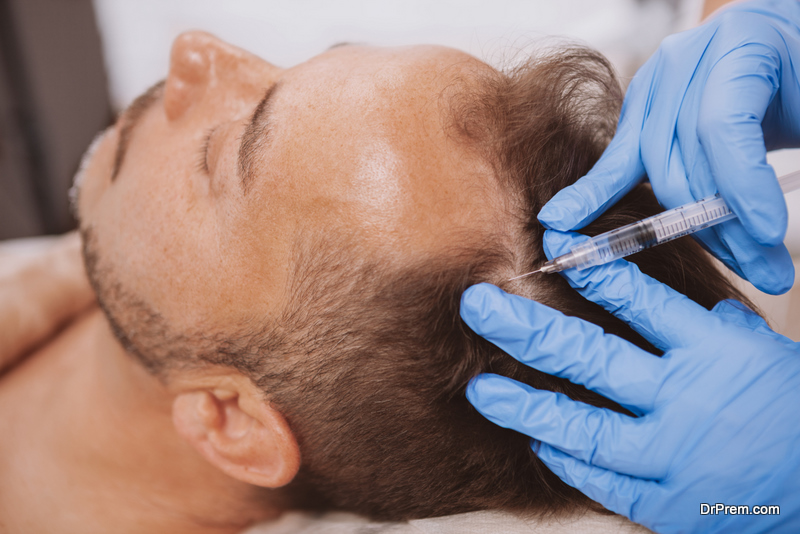 Close up of a mature man receiving hairloss treatment injections in scalp by professional trichologist