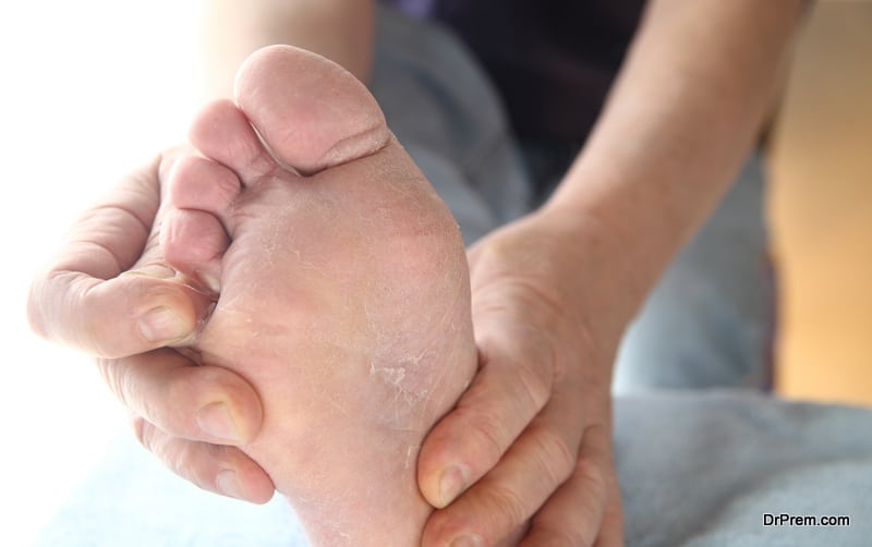 Simple and Practical Tips to Prevent Foot Fungal Infections
